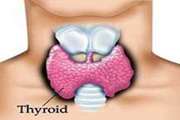 درباره سرطان تیروئید چه می دانید؟