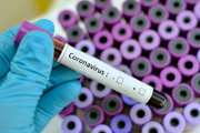 پرسش و پاسخ های متداول درموردکروناویروس جدید(کوید-19)بر اساس آخرین اطلاعات سایت سازمان جهانی بهداشت(WHO)